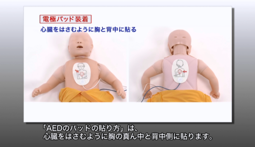 乳児は「AED」の貼り方が全然違うって知ってた？